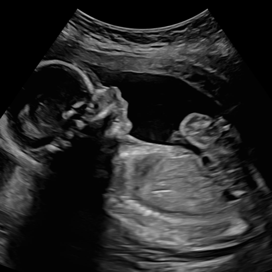 Photo shared by Riley for their Babylist baby registry.