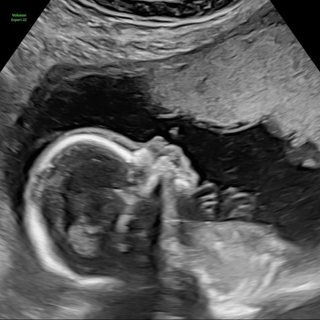 Photo shared by Alyssa for their Babylist baby registry.