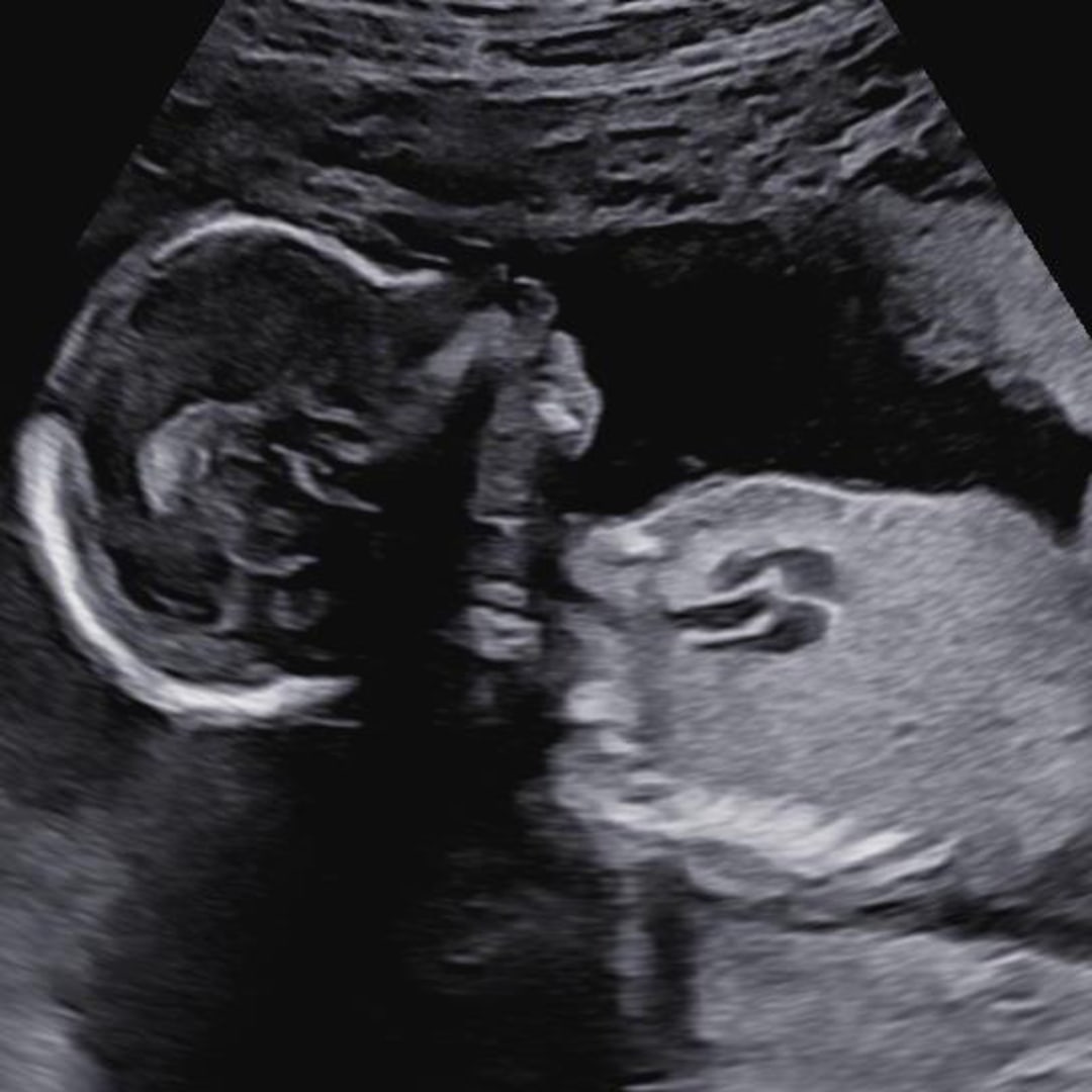 Photo shared by Mary for their Babylist baby registry.