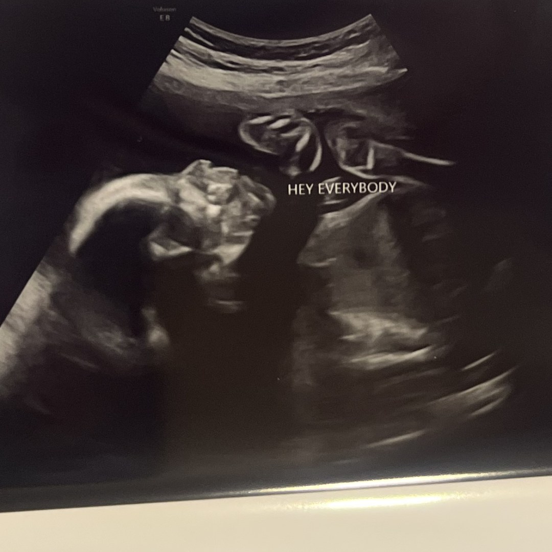 Photo shared by Carleigh for their Babylist baby registry.