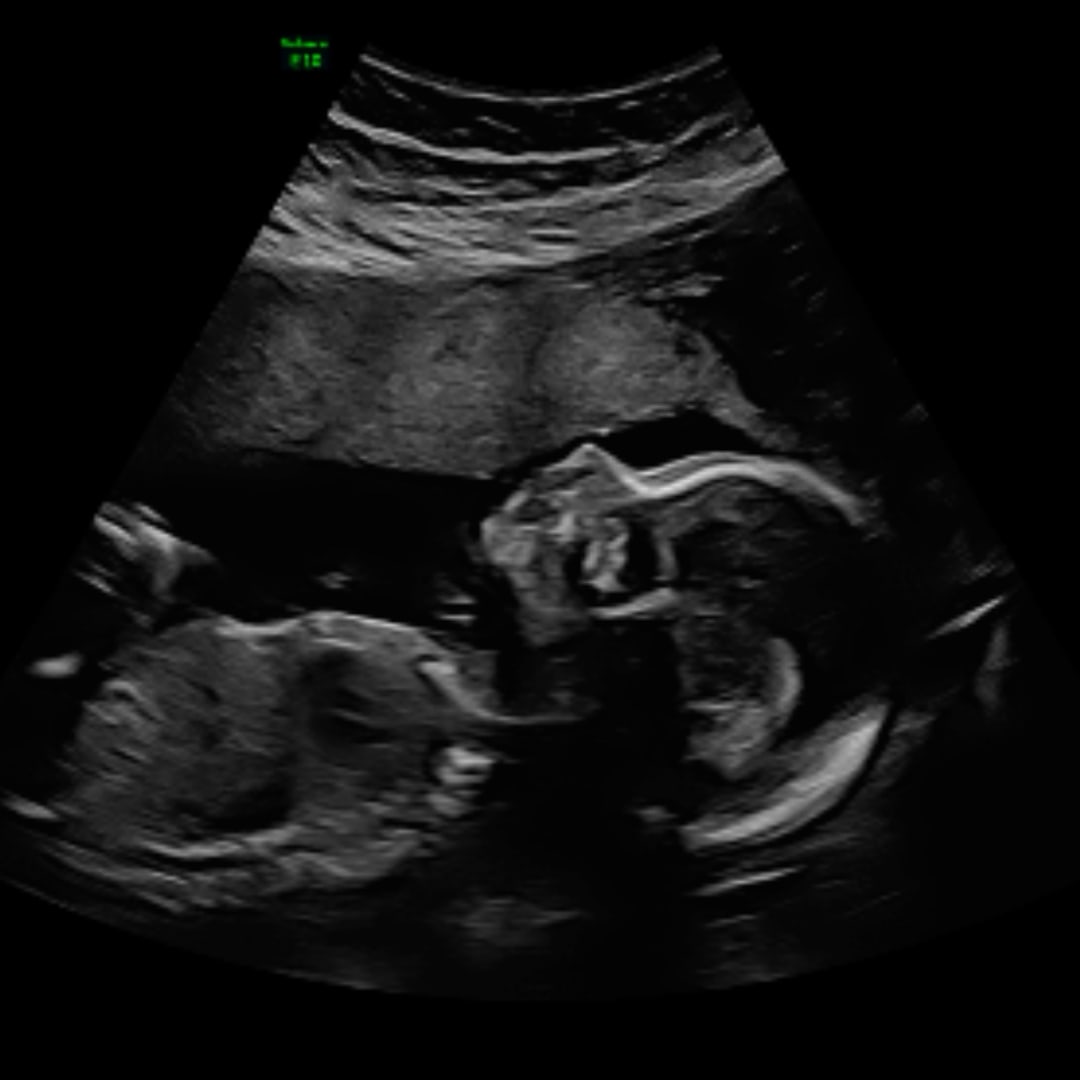 Photo shared by Leah for their Babylist baby registry.