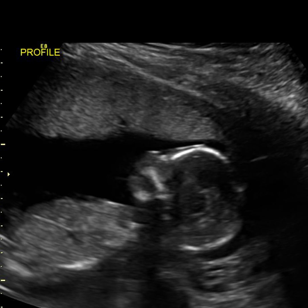 Photo shared by Alyssa for their Babylist baby registry.