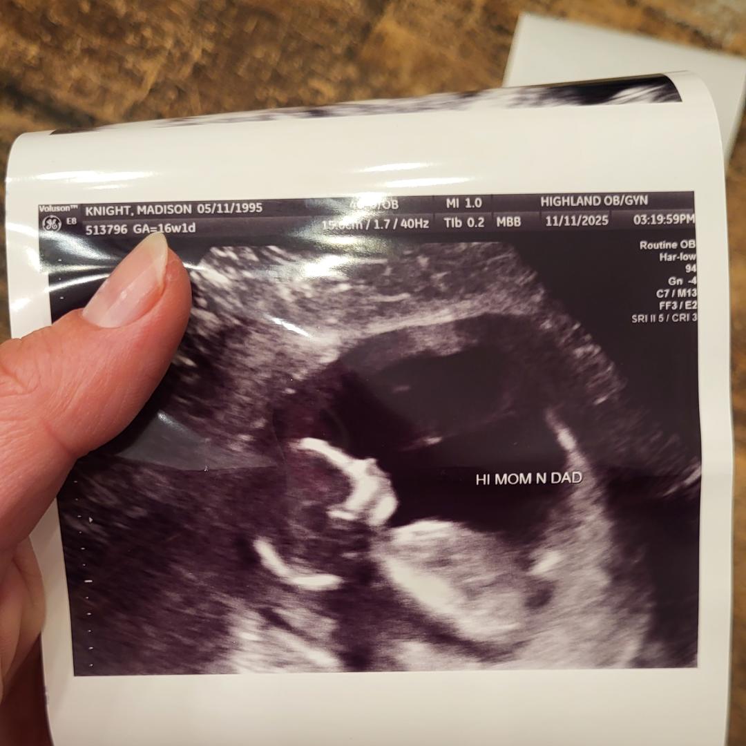 Photo shared by Madison for their Babylist baby registry.