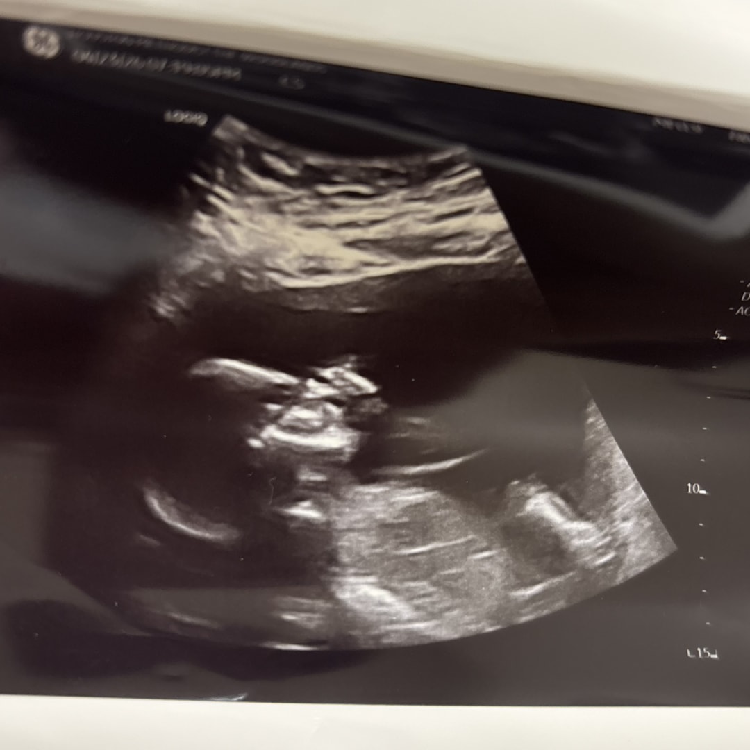 Photo shared by Tytiana for their Babylist baby registry.