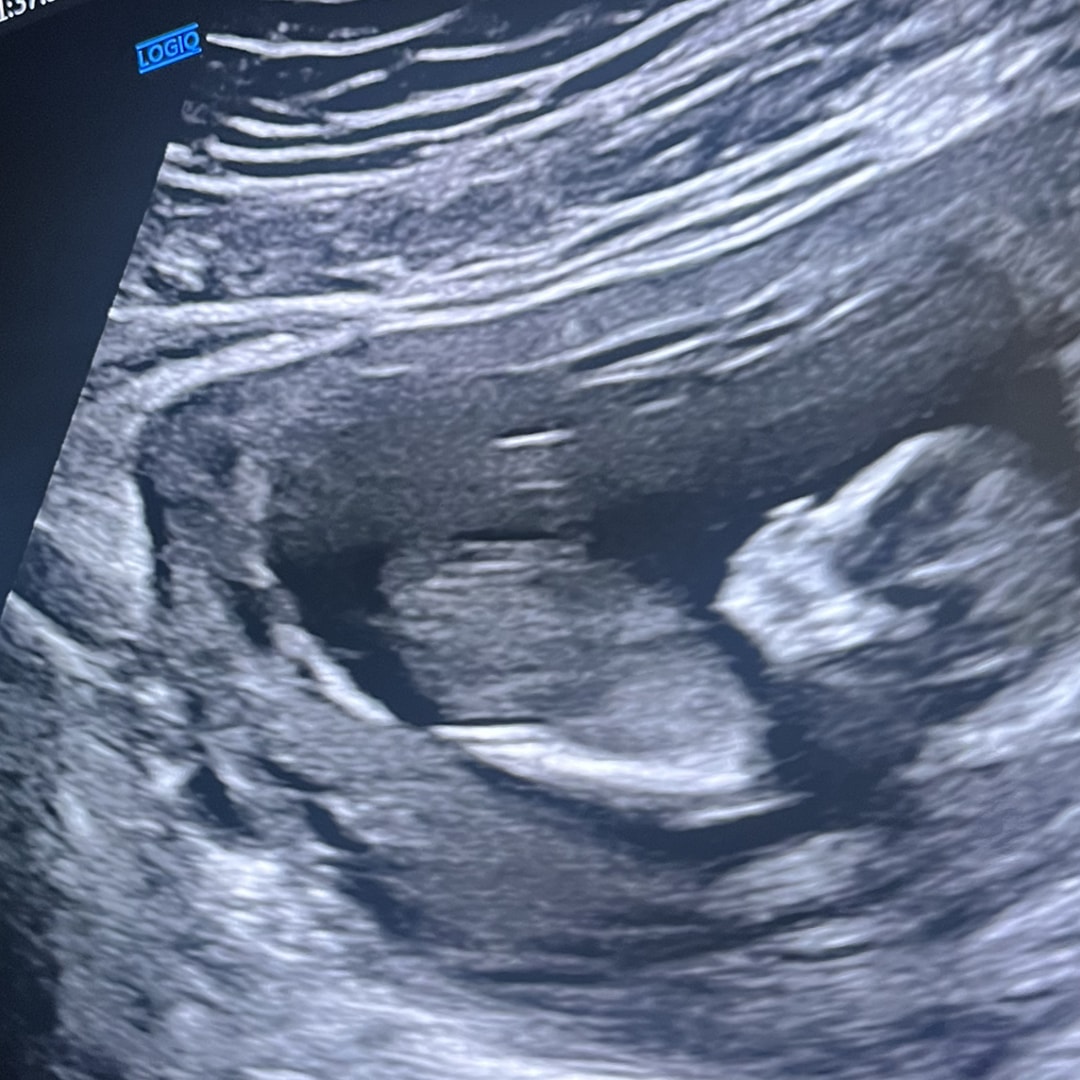 Photo shared by Aundria for their Babylist baby registry.