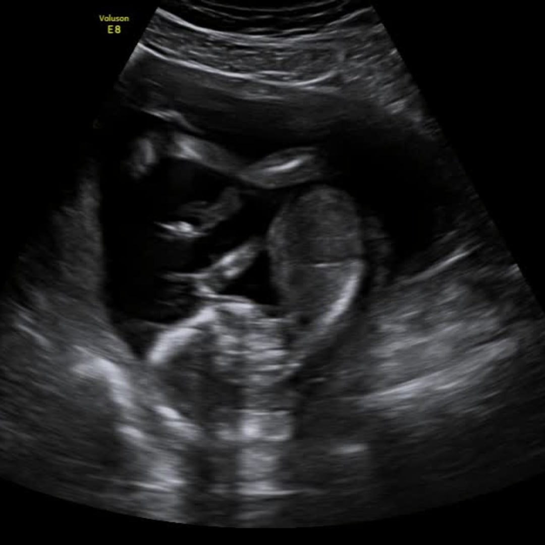 Photo shared by Valerie for their Babylist baby registry.