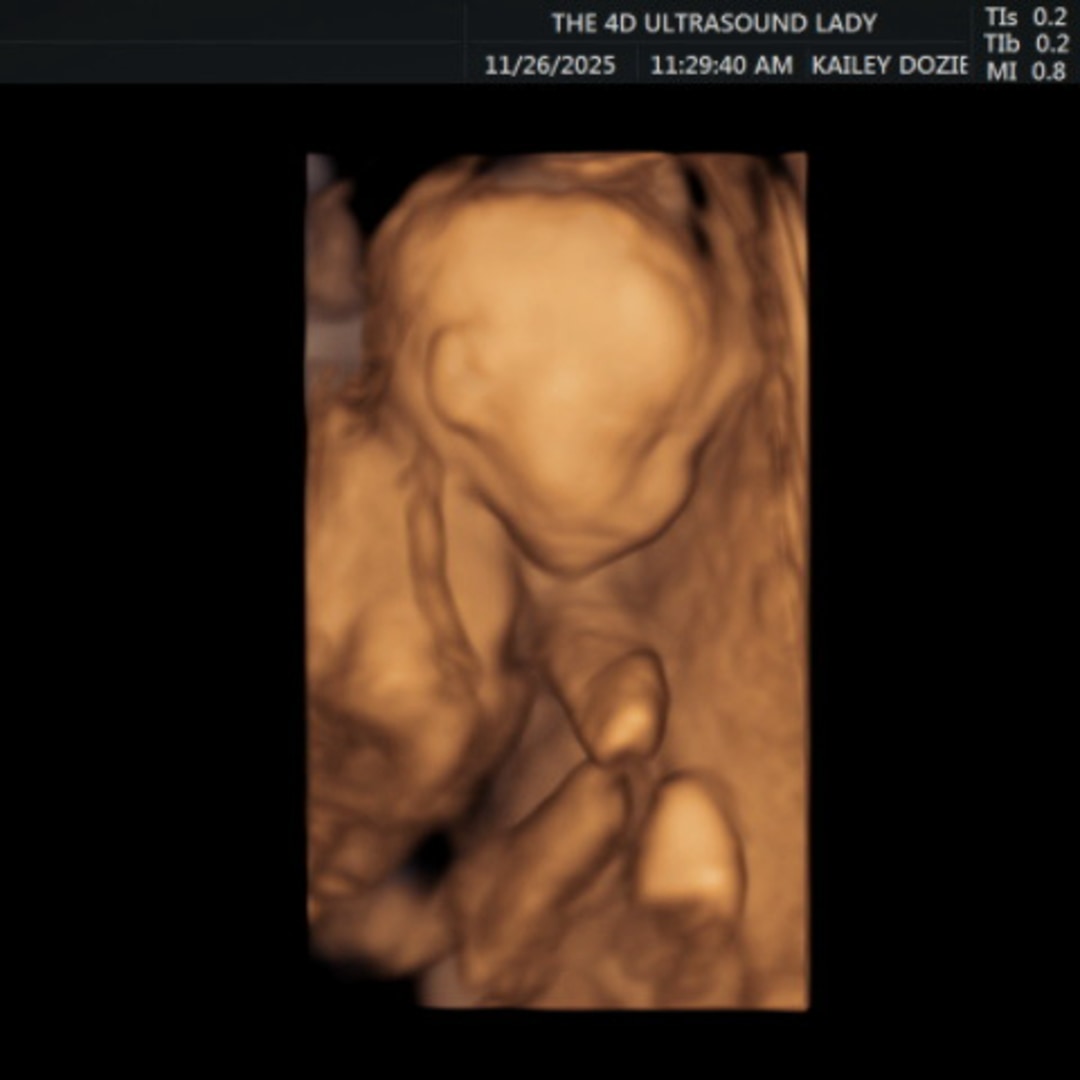 Photo shared by Champaine for their Babylist baby registry.