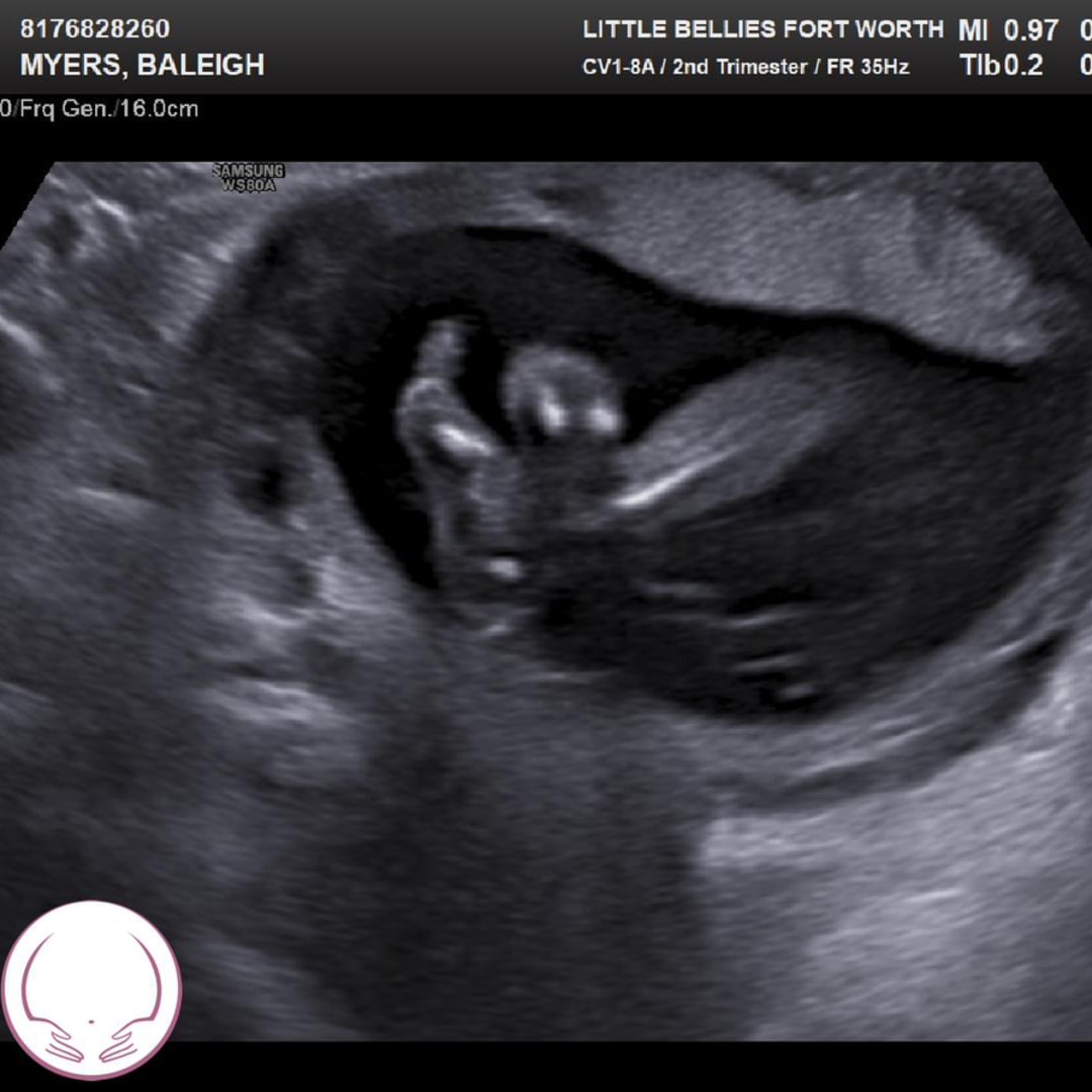 Photo shared by Baleigh for their Babylist baby registry.