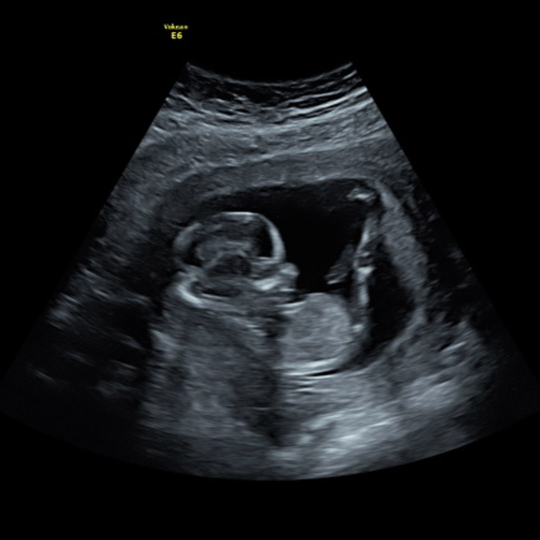 Photo shared by Daisy for their Babylist baby registry.