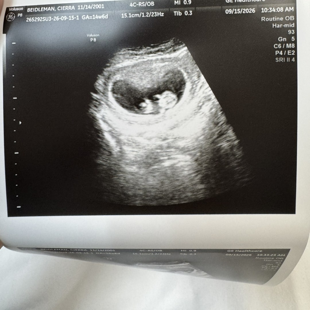 Photo shared by Cierra for their Babylist baby registry.