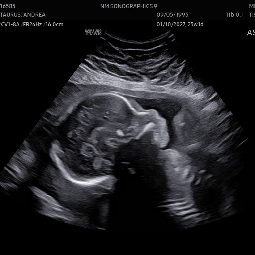 Photo shared by Andrea for their Babylist baby registry.