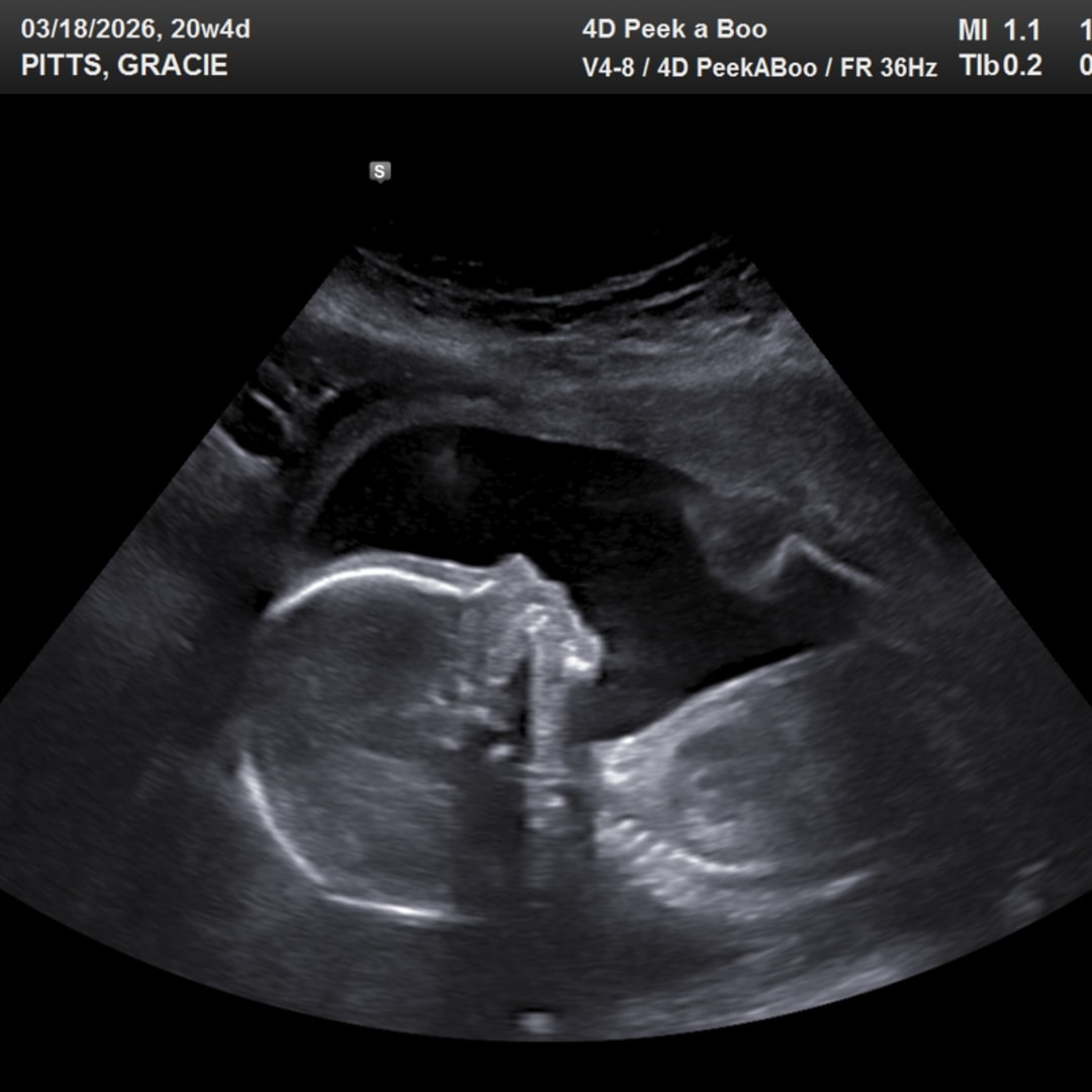 Photo shared by Gracie for their Babylist baby registry.