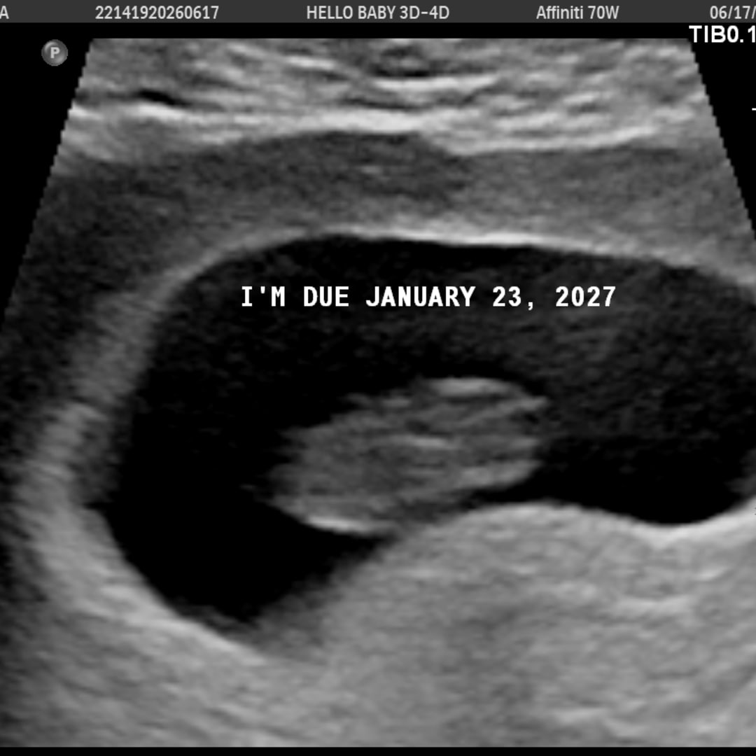 Photo shared by Carina for their Babylist baby registry.