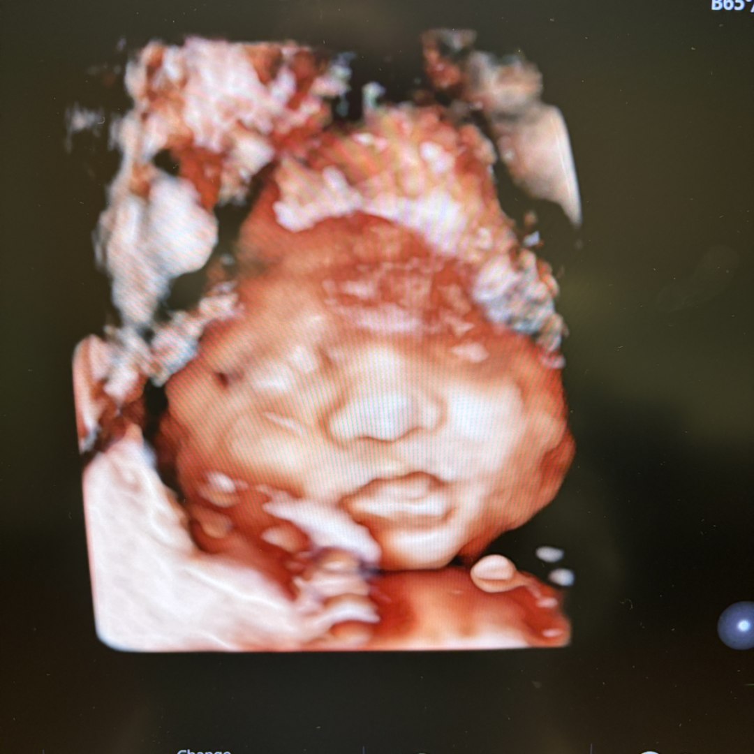 Photo shared by Christine for their Babylist baby registry.