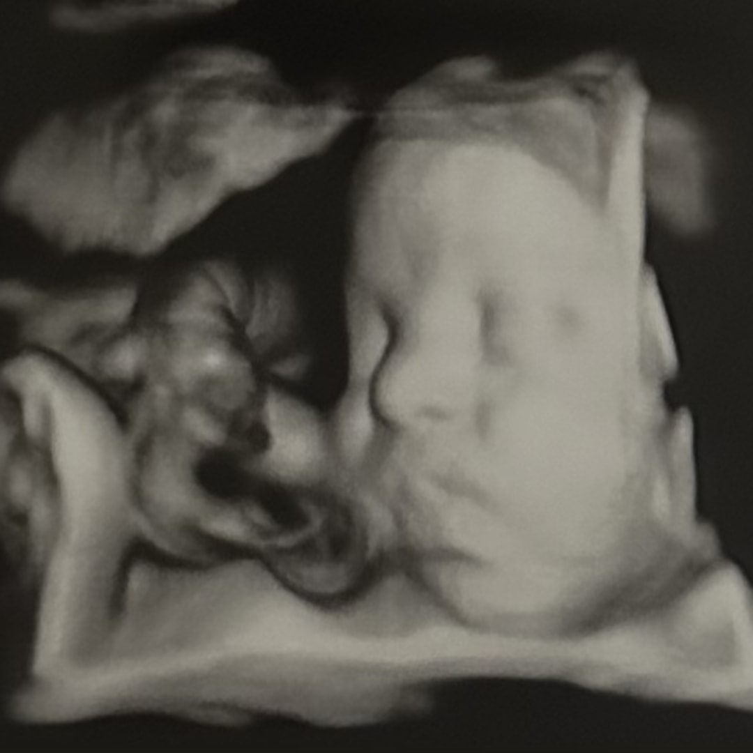 Photo shared by Jacqueline for their Babylist baby registry.