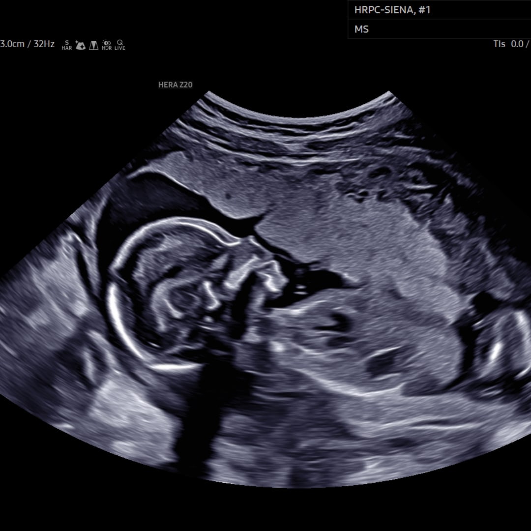 Photo shared by BonneDora for their Babylist baby registry.