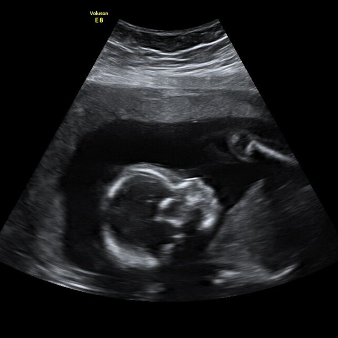 Photo shared by Breanna for their Babylist baby registry.