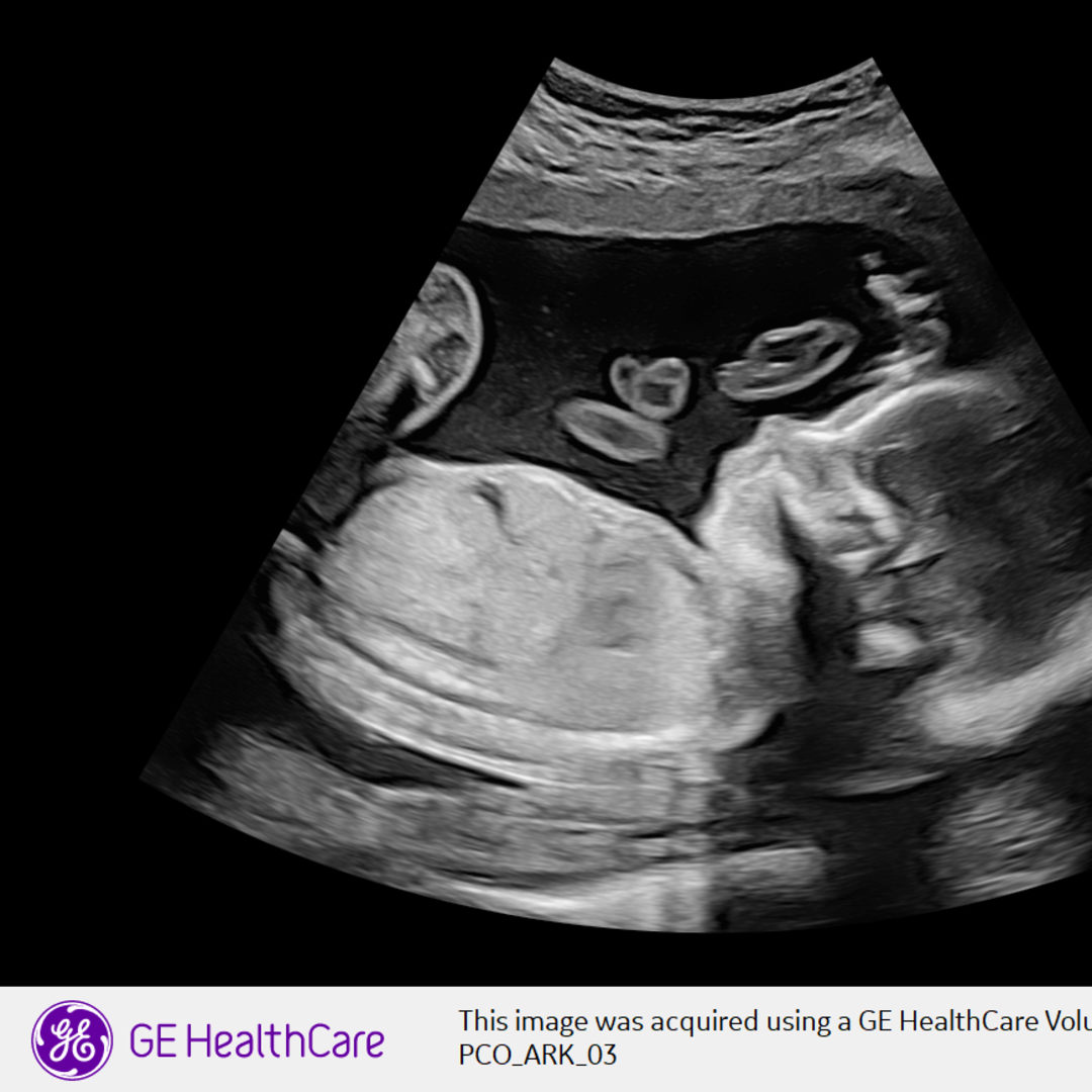 Photo shared by Lexi for their Babylist baby registry.