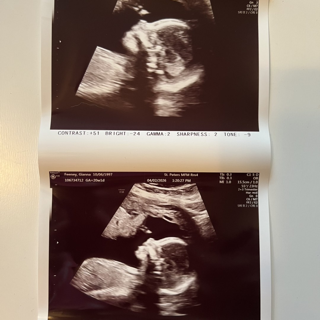 Photo shared by Gianna for their Babylist baby registry.