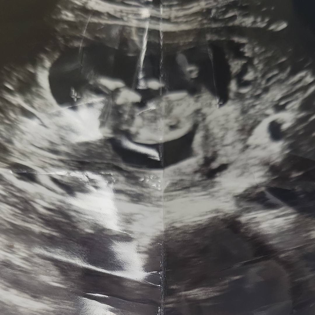 Photo shared by Sandra for their Babylist baby registry.