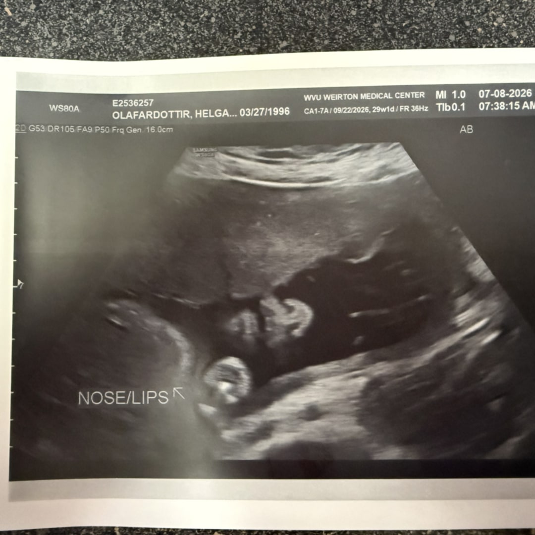 Photo shared by Helga for their Babylist baby registry.