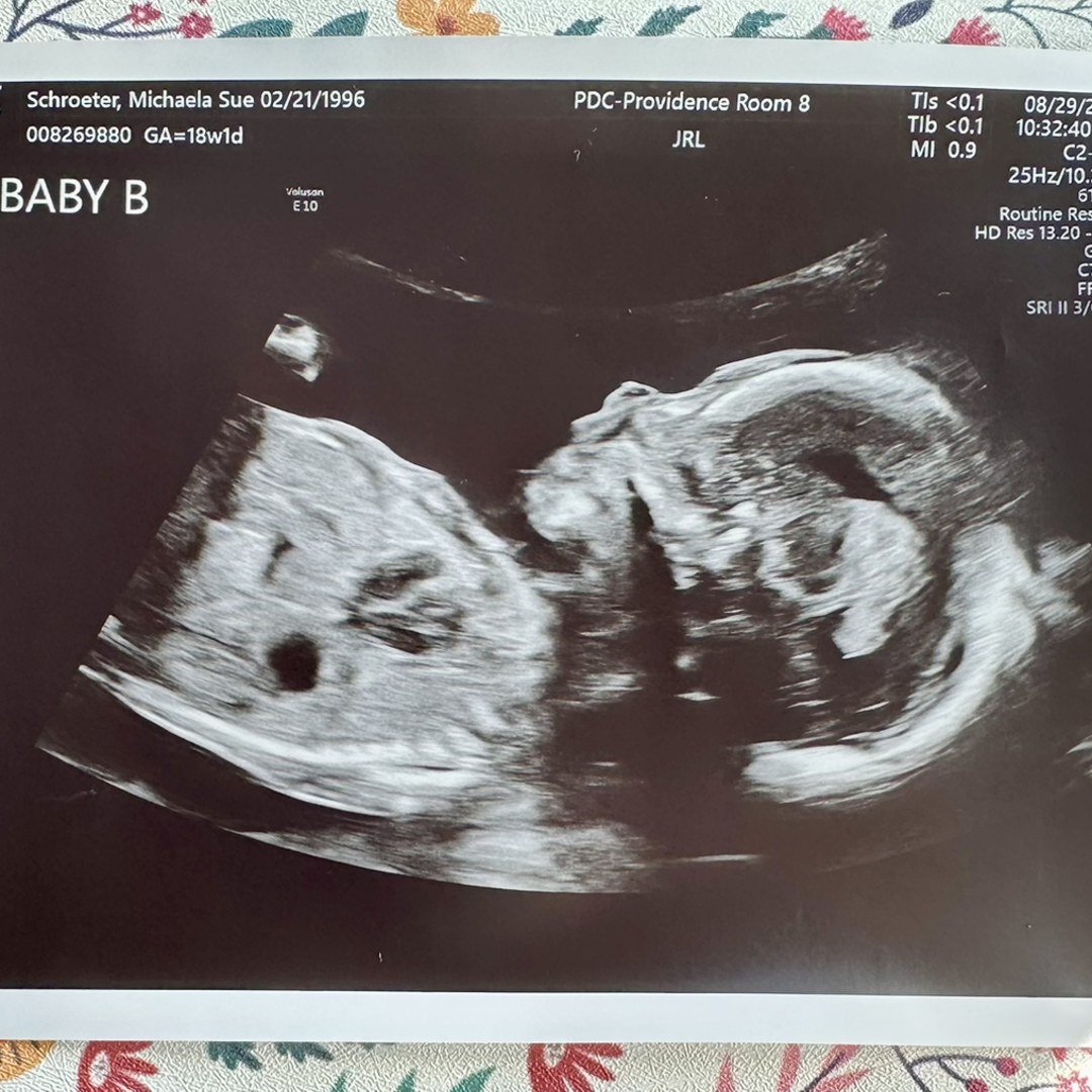 Photo shared by Michaela for their Babylist baby registry.