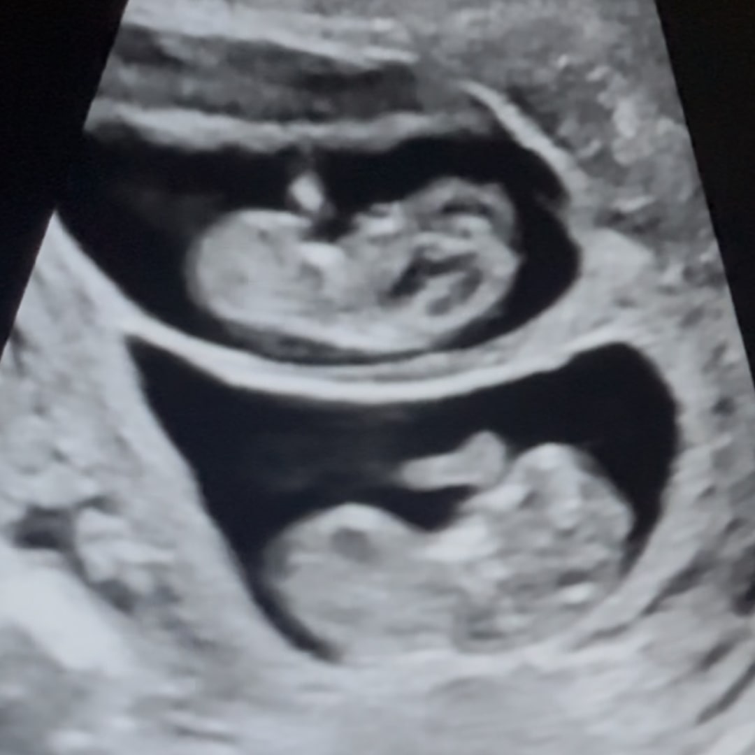 Photo shared by Brooke for their Babylist baby registry.