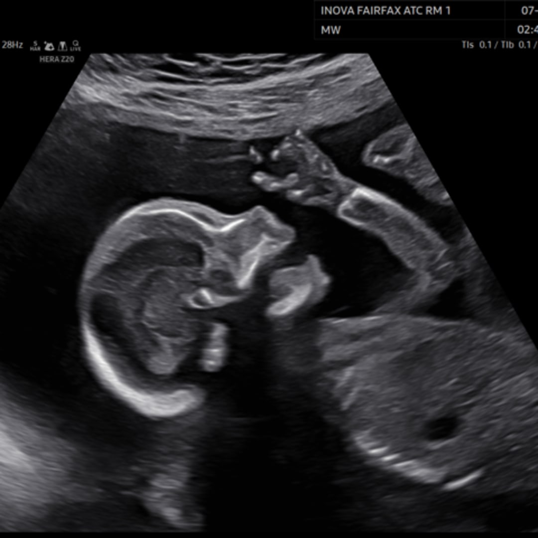 Photo shared by Katie for their Babylist baby registry.