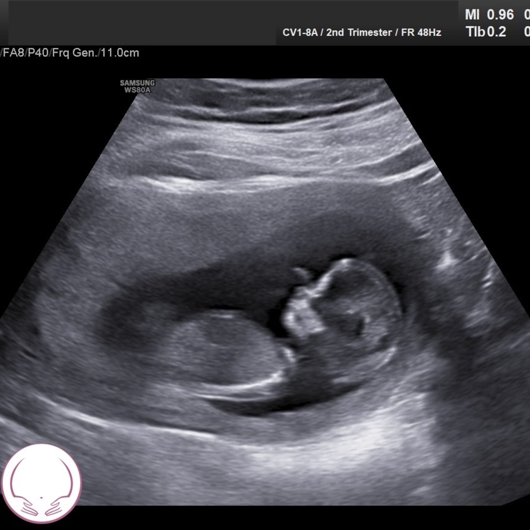 Photo shared by Kaitlyn for their Babylist baby registry.