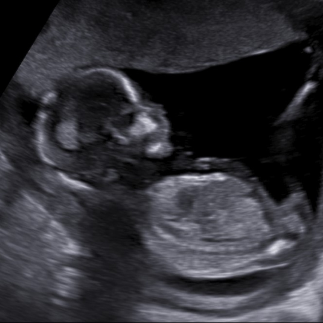 Photo shared by Carmen for their Babylist baby registry.