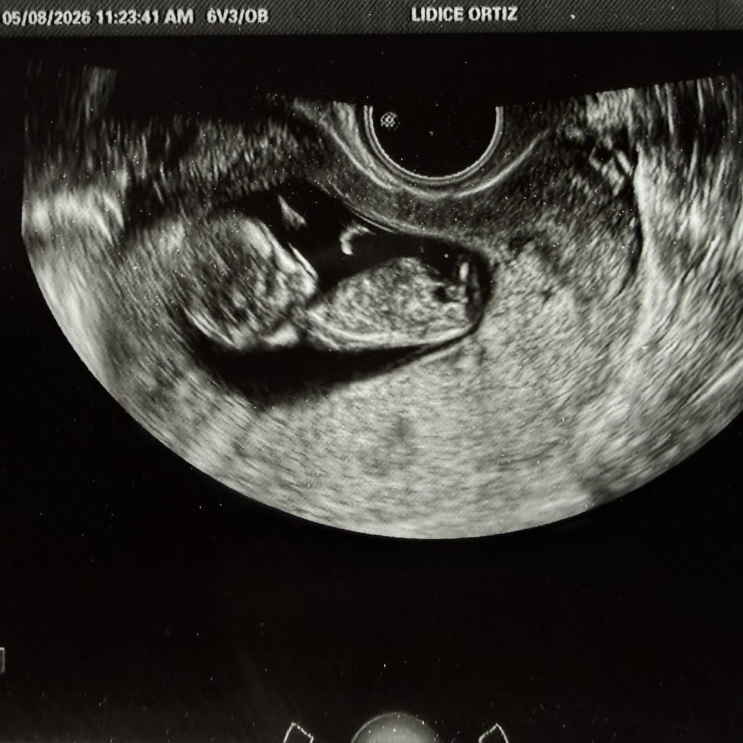 Photo shared by Lidice for their Babylist baby registry.