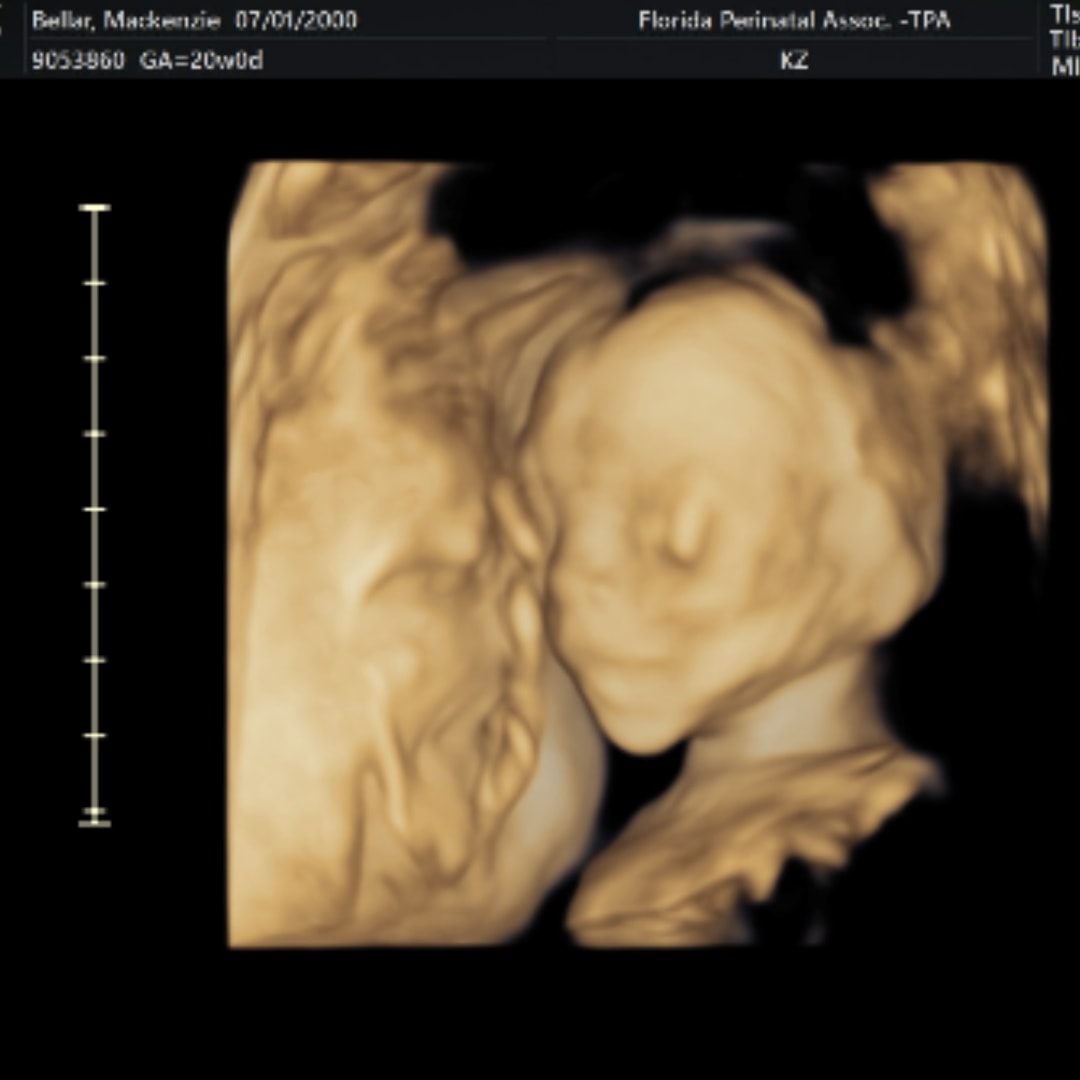 Photo shared by Mackenzie for their Babylist baby registry.