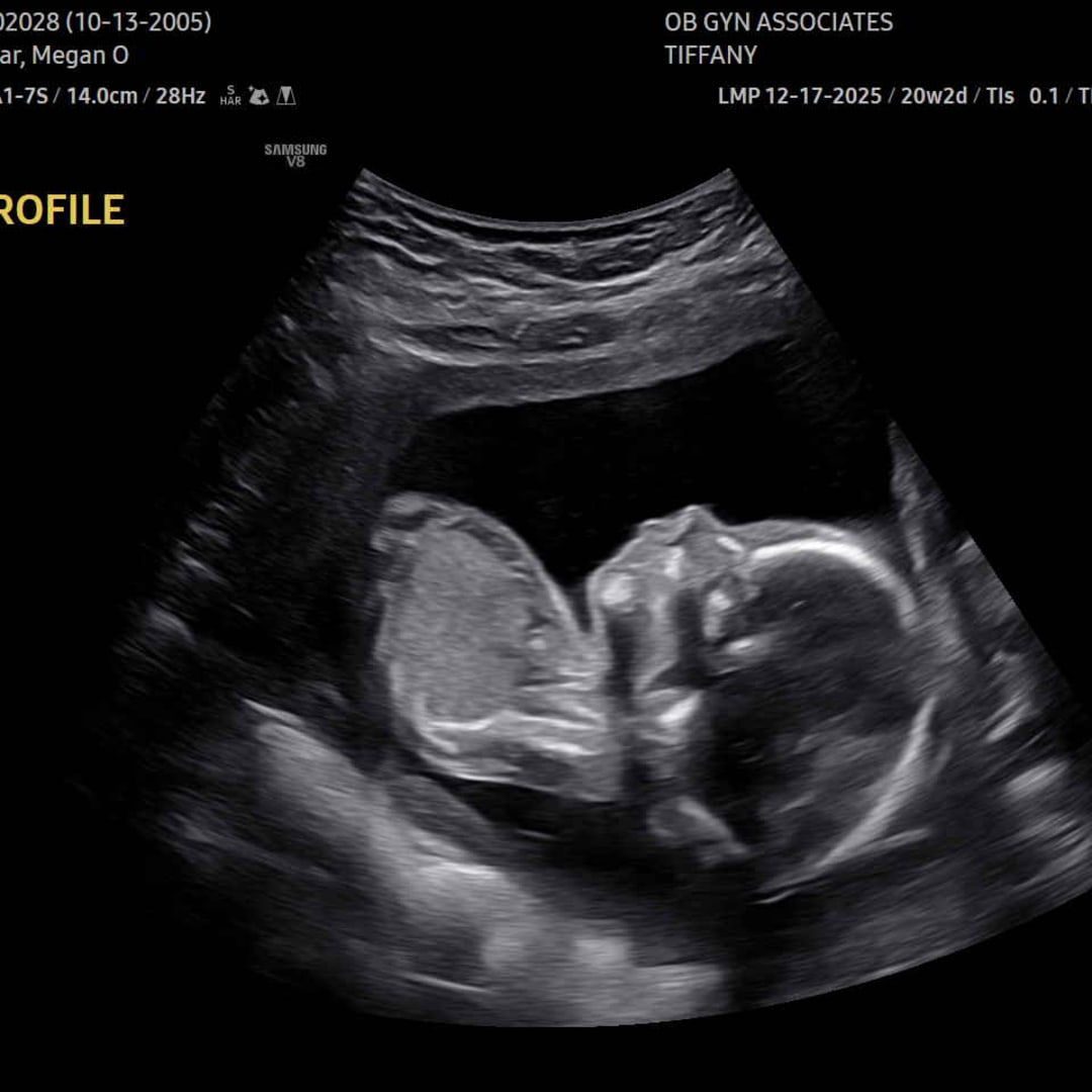 Photo shared by Megan for their Babylist baby registry.