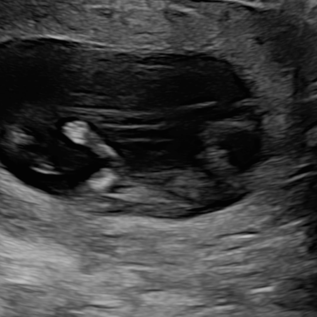 Photo shared by Rebekah for their Babylist baby registry.