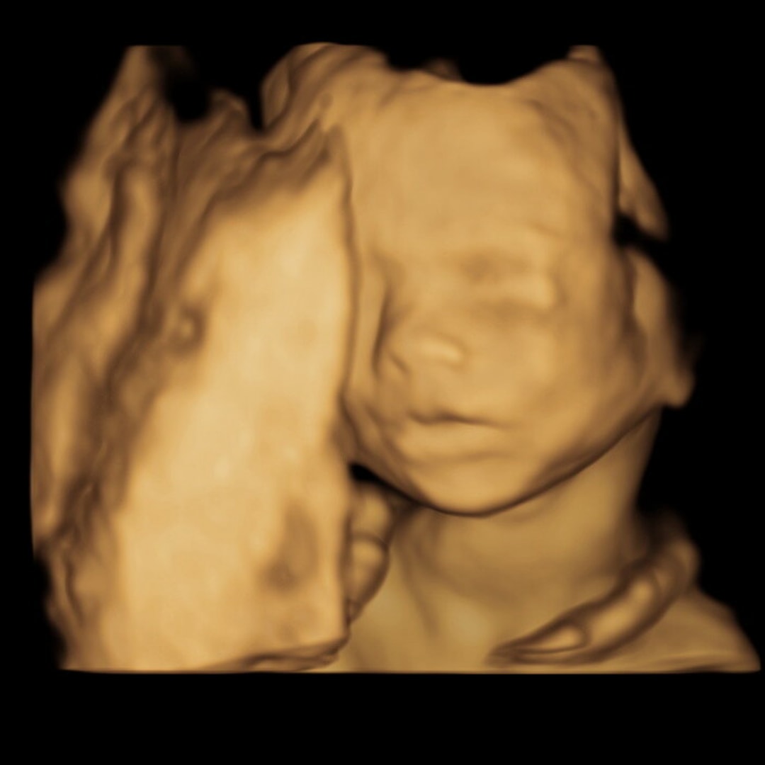 Photo shared by Nicolette for their Babylist baby registry.