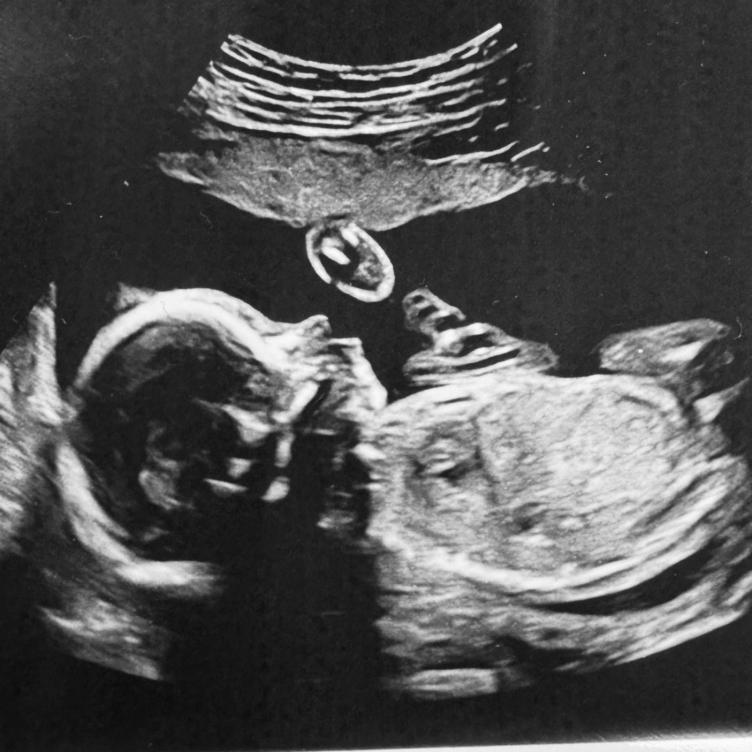 Photo shared by Rachel for their Babylist baby registry.