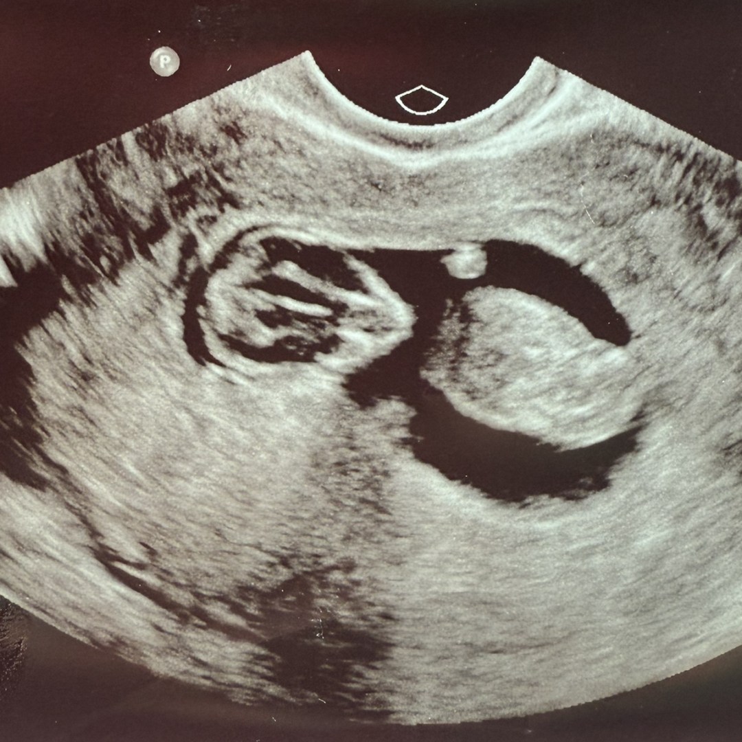 Photo shared by Rashel for their Babylist baby registry.