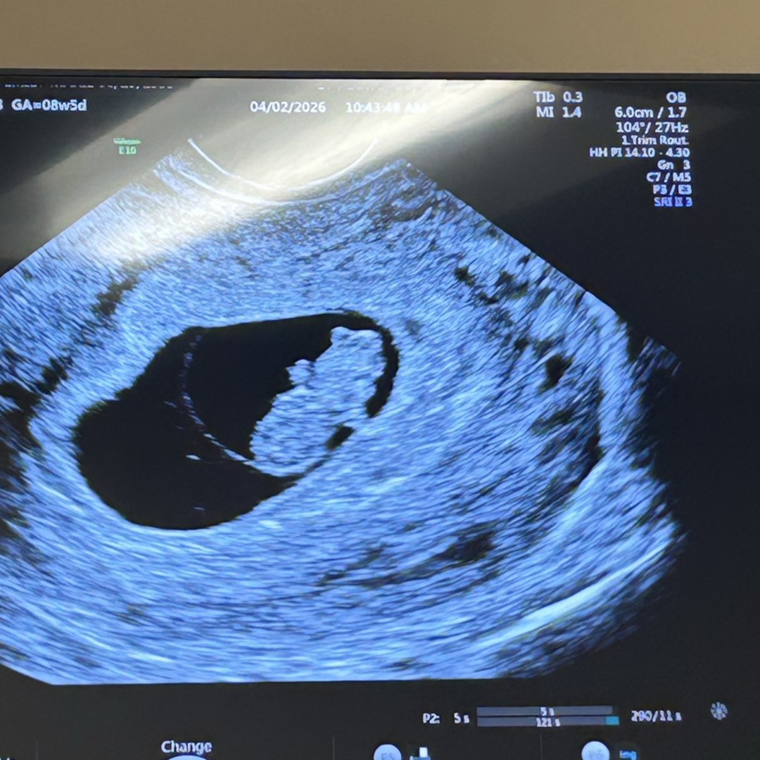 Photo shared by Emily for their Babylist baby registry.