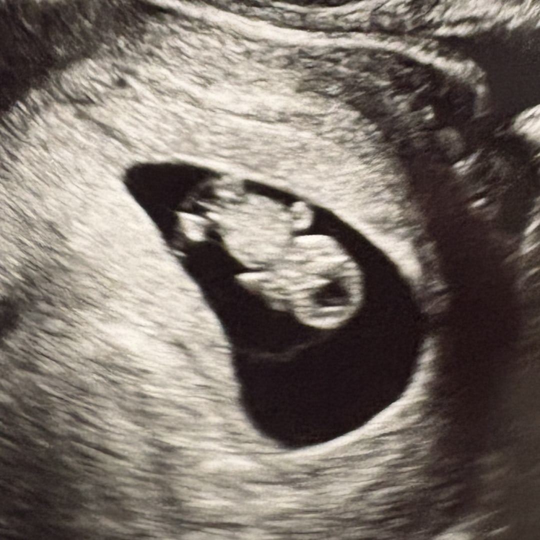 Photo shared by Hannah for their Babylist baby registry.