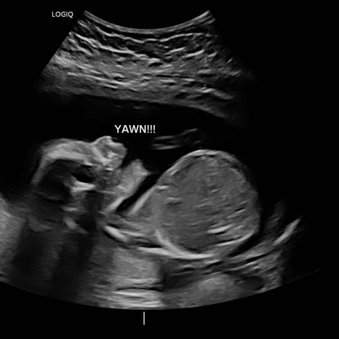 Photo shared by Holli for their Babylist baby registry.