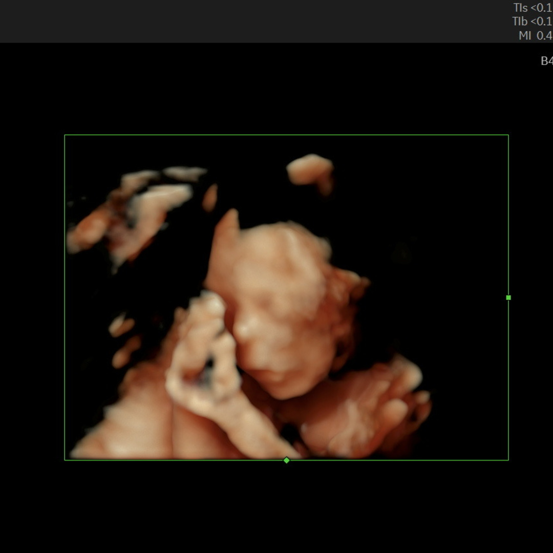 Photo shared by Bella for their Babylist baby registry.