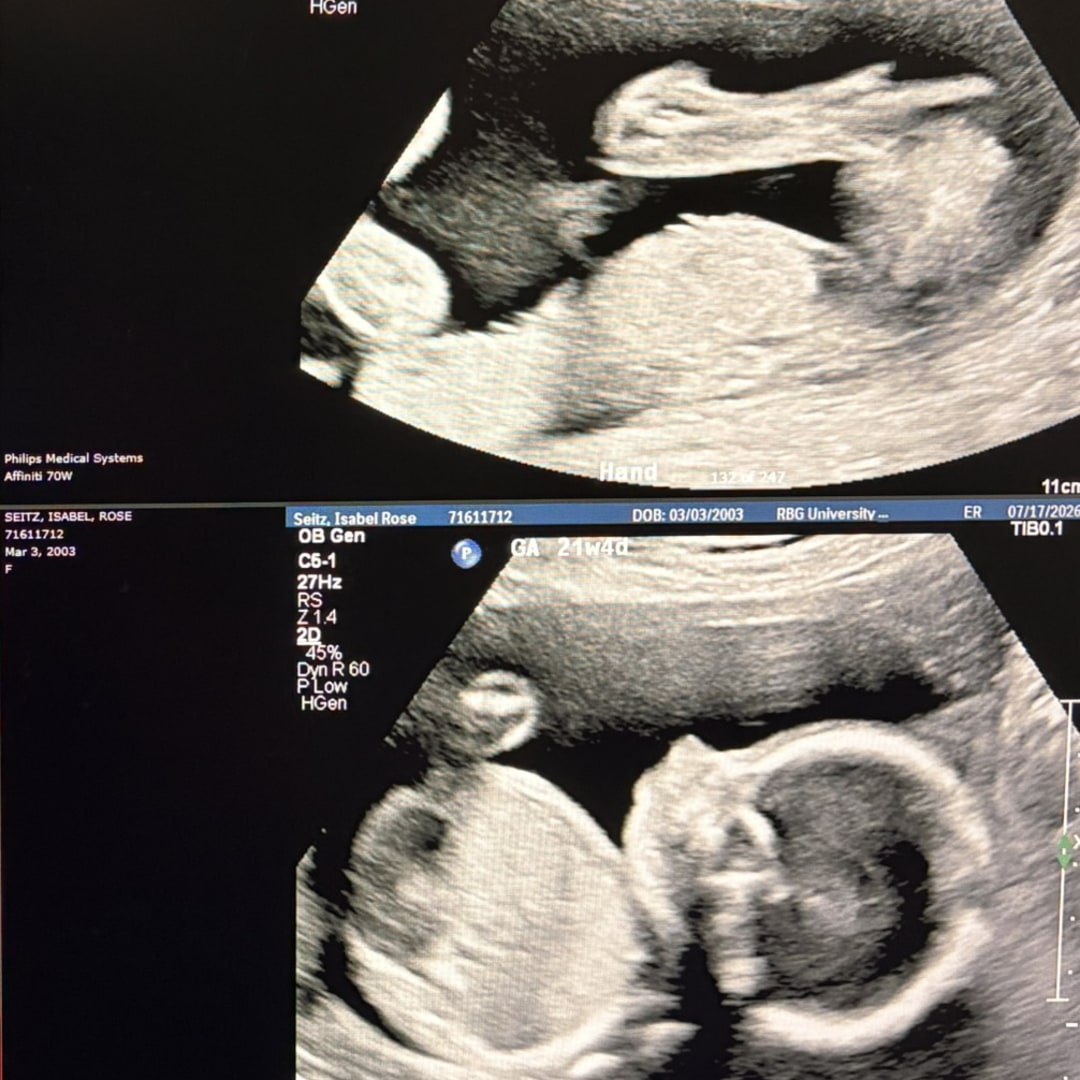 Photo shared by Isabel for their Babylist baby registry.