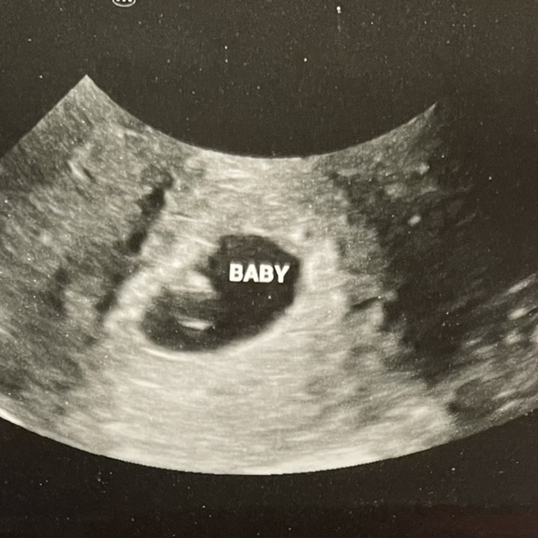 Photo shared by Marissa for their Babylist baby registry.