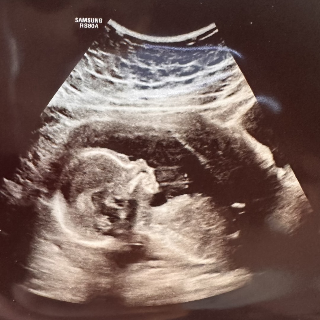 Photo shared by Julia for their Babylist baby registry.