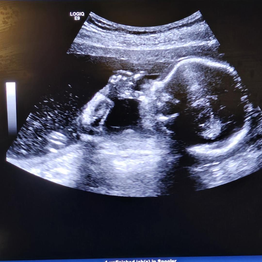 Photo shared by Elizabeth for their Babylist baby registry.