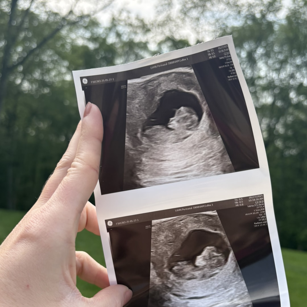Photo shared by Alexandria for their Babylist baby registry.
