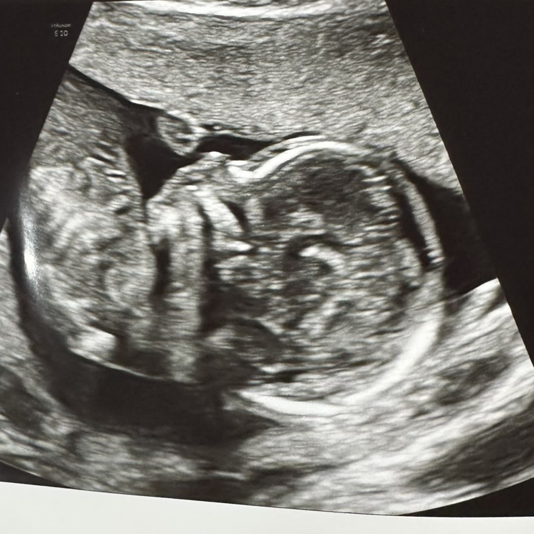 Photo shared by Lynn for their Babylist baby registry.