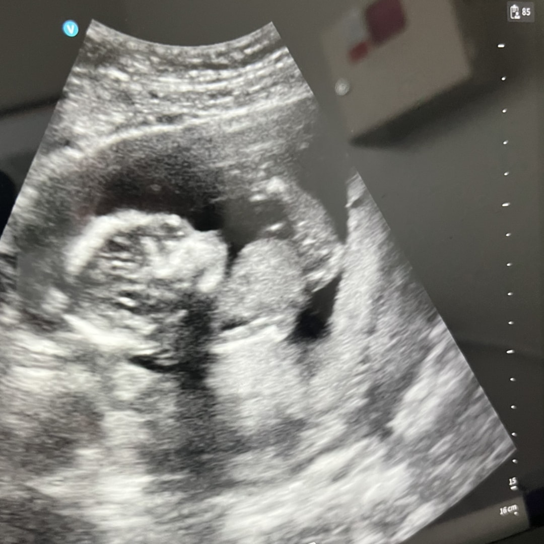 Photo shared by Alexa for their Babylist baby registry.