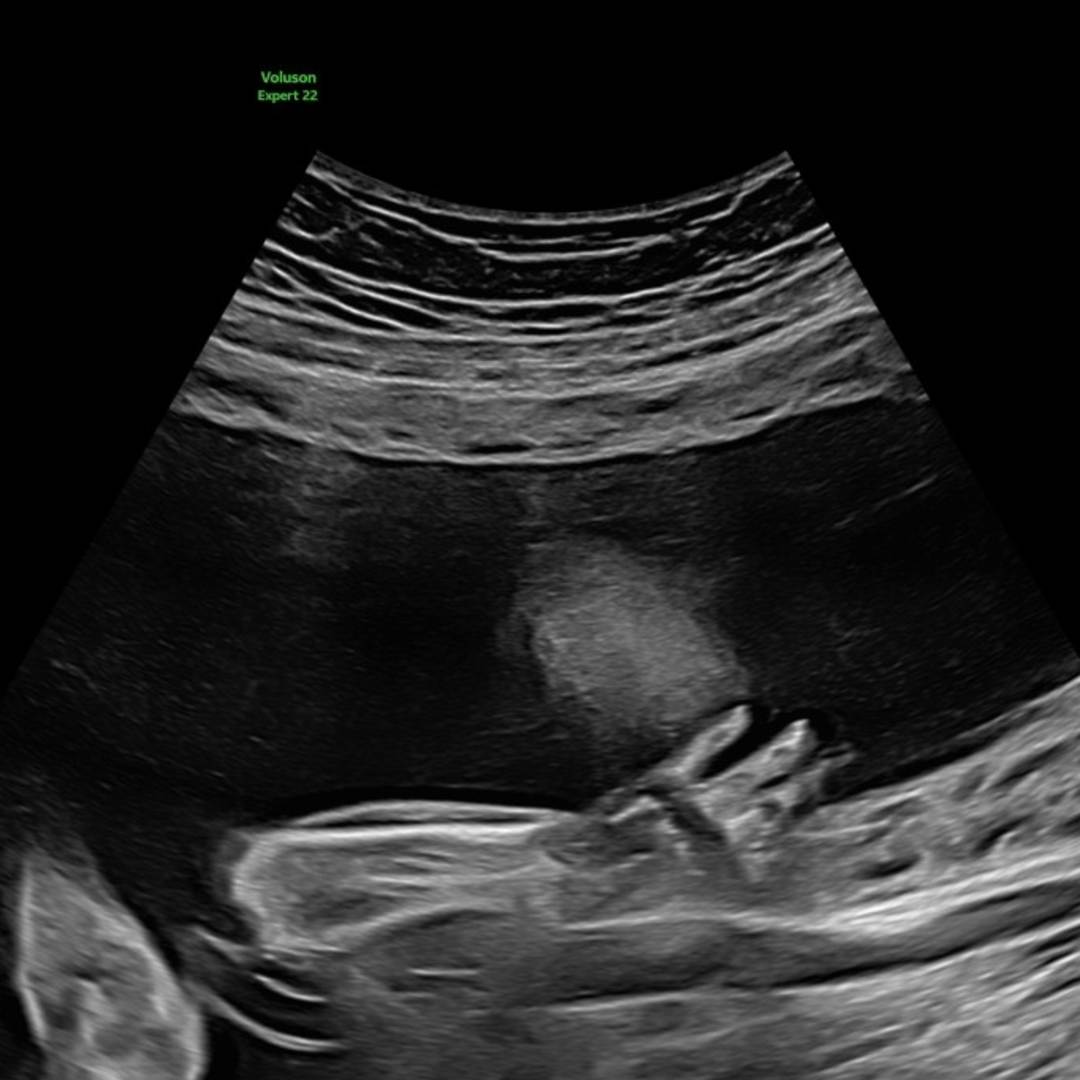 Photo shared by Moon for their Babylist baby registry.