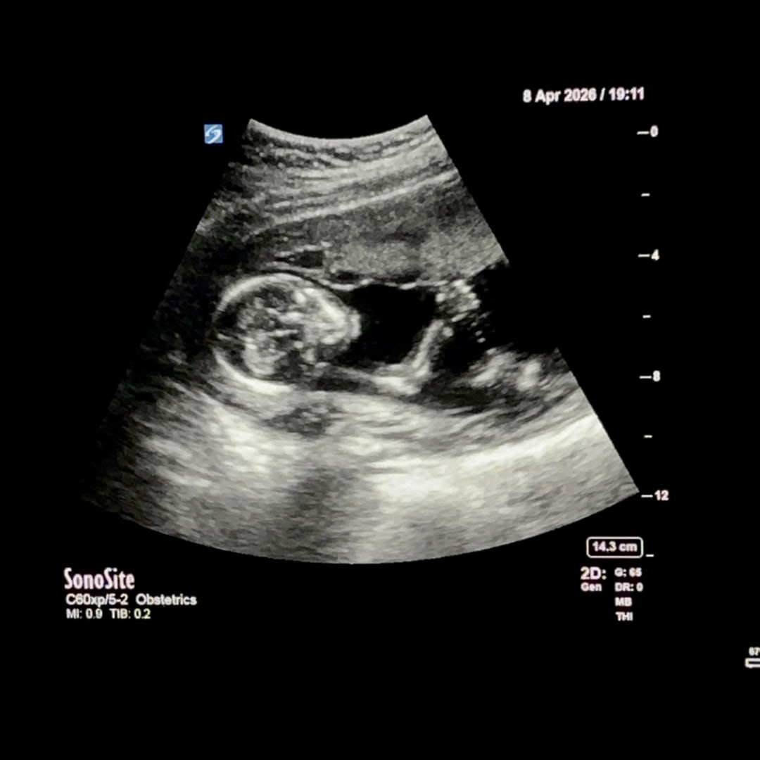 Photo shared by Brooklynn for their Babylist baby registry.
